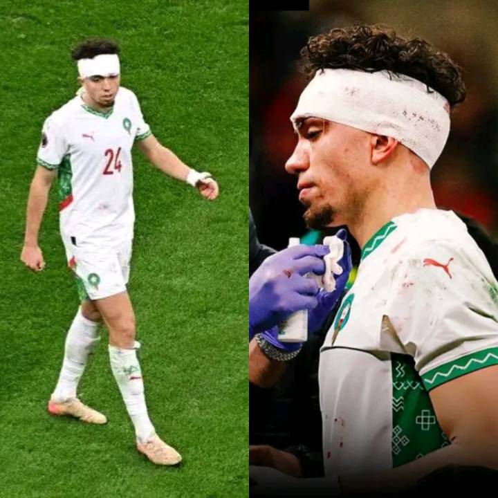 هُزِمنا في المباراة، لكننا حققنا إنجازًا سبع مرات. ريتو أضافها في الملعب، لكنه لم يسجل.